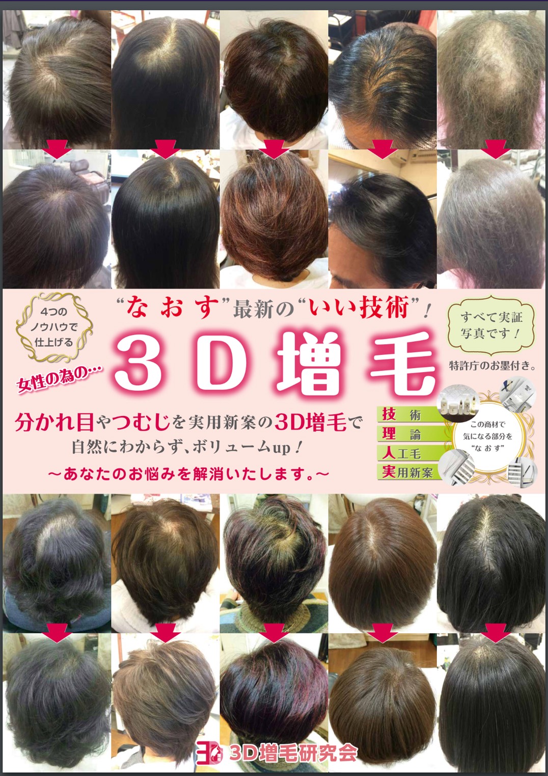 埼玉県女性の薄毛 抜け毛に特化したメニューのある美容室オズ ブログ